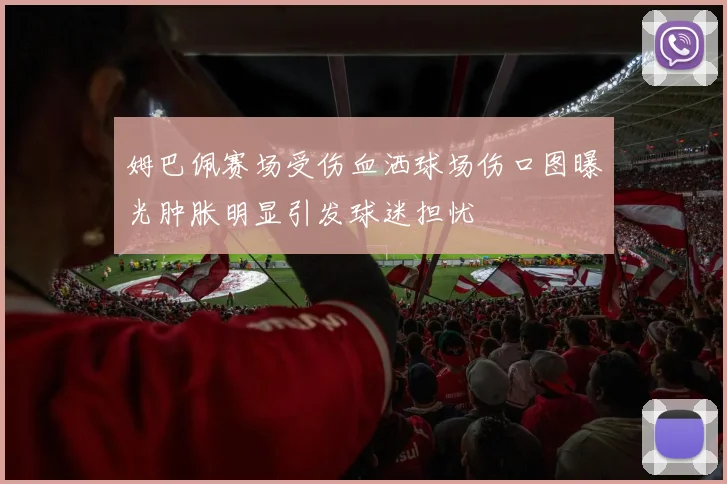姆巴佩赛场受伤血洒球场伤口图曝光肿胀明显引发球迷担忧
